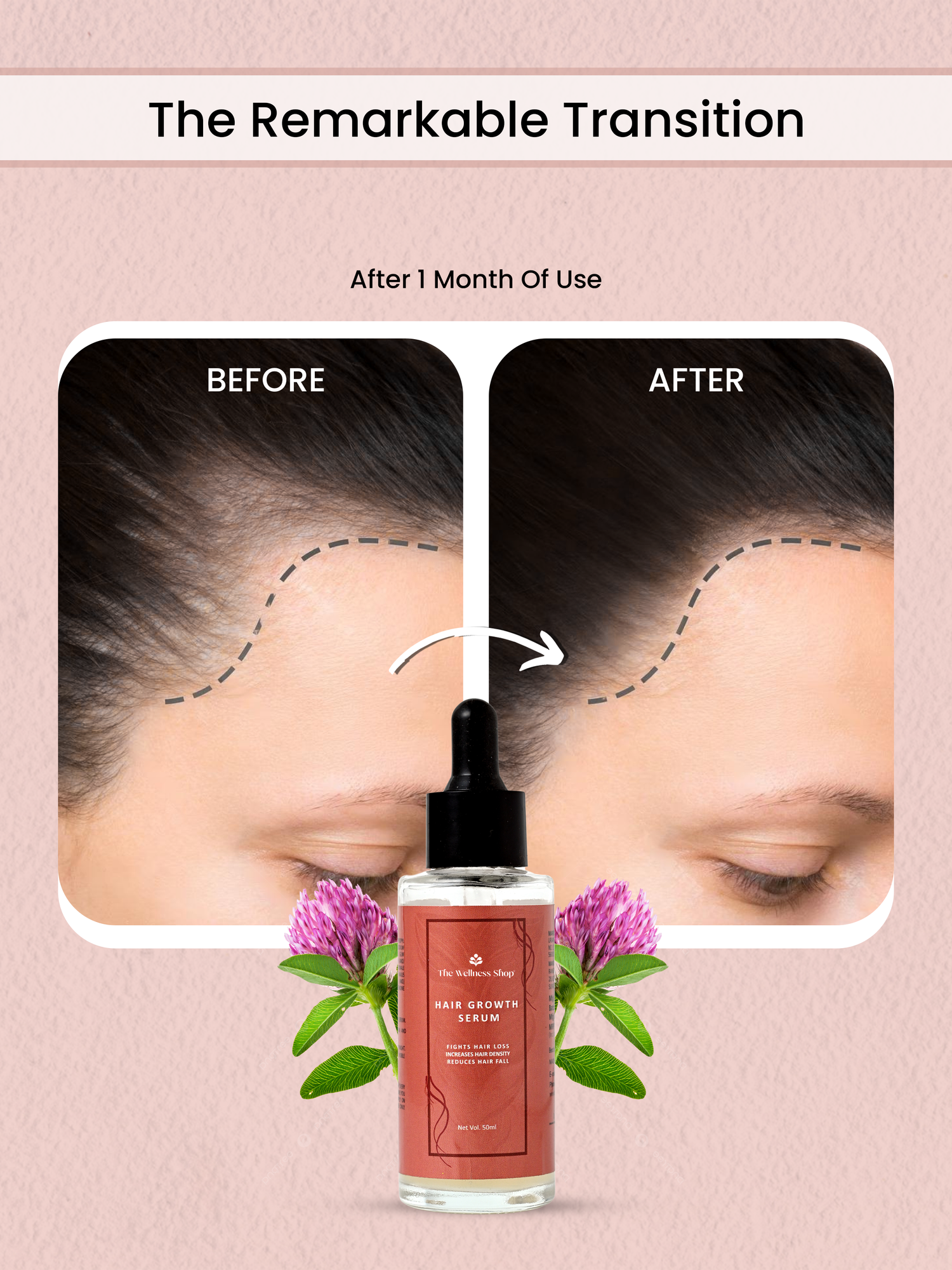 ORGANIC HAIR GROWTH SERUM (CONTROL HAIR FALL IN 4 WEEKS)