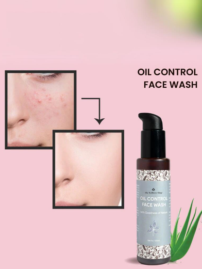 OIL CONTROL FACE WASH FOR ACNE &amp; SEBUM CONTROL (NO PARABEN , NO SULPHATE)