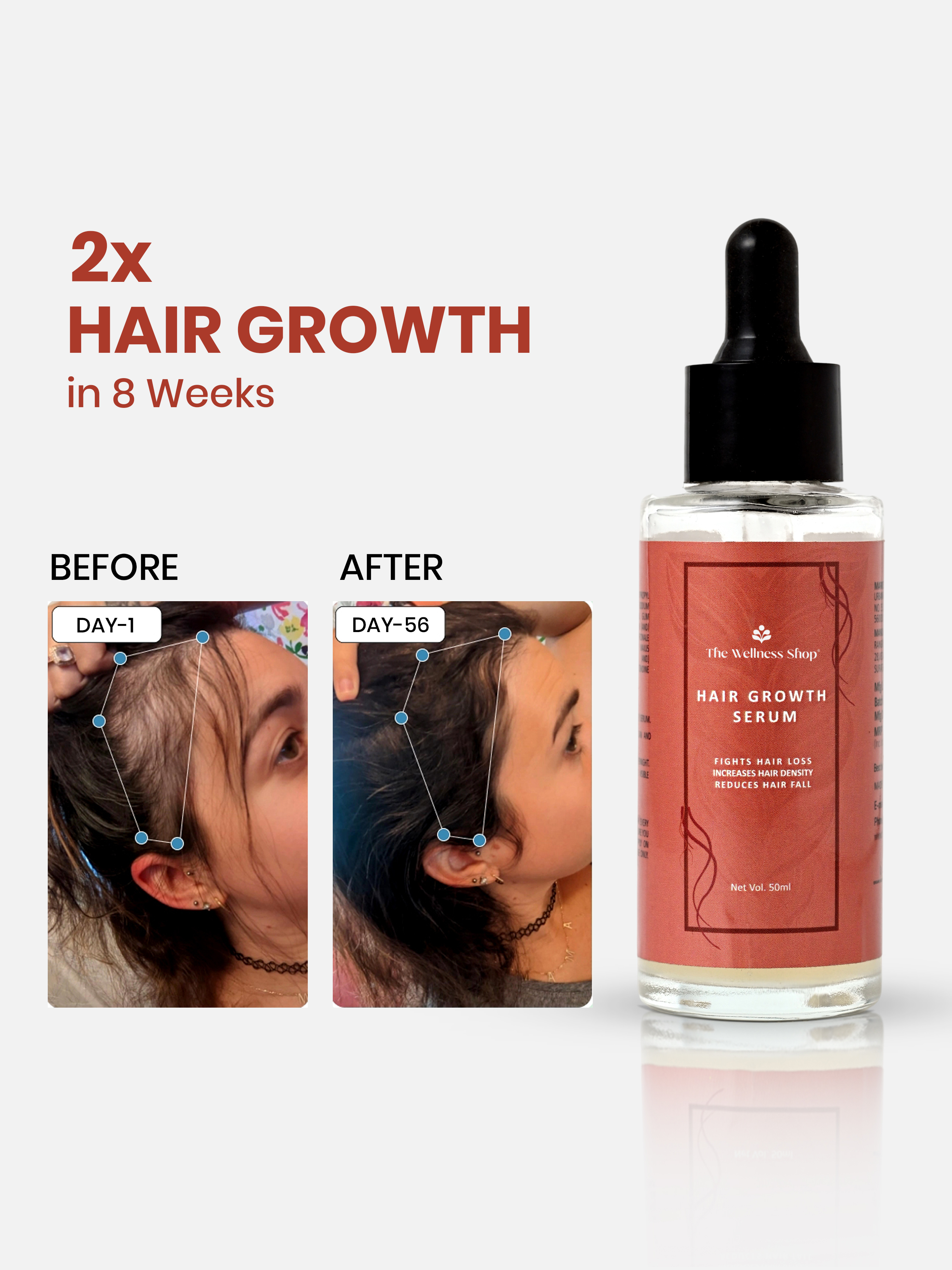 HAIR GROWTH SERUM CONCENTRATE WITH 3% REDENSYL, 4% ANAGAIN AND RICE WATER