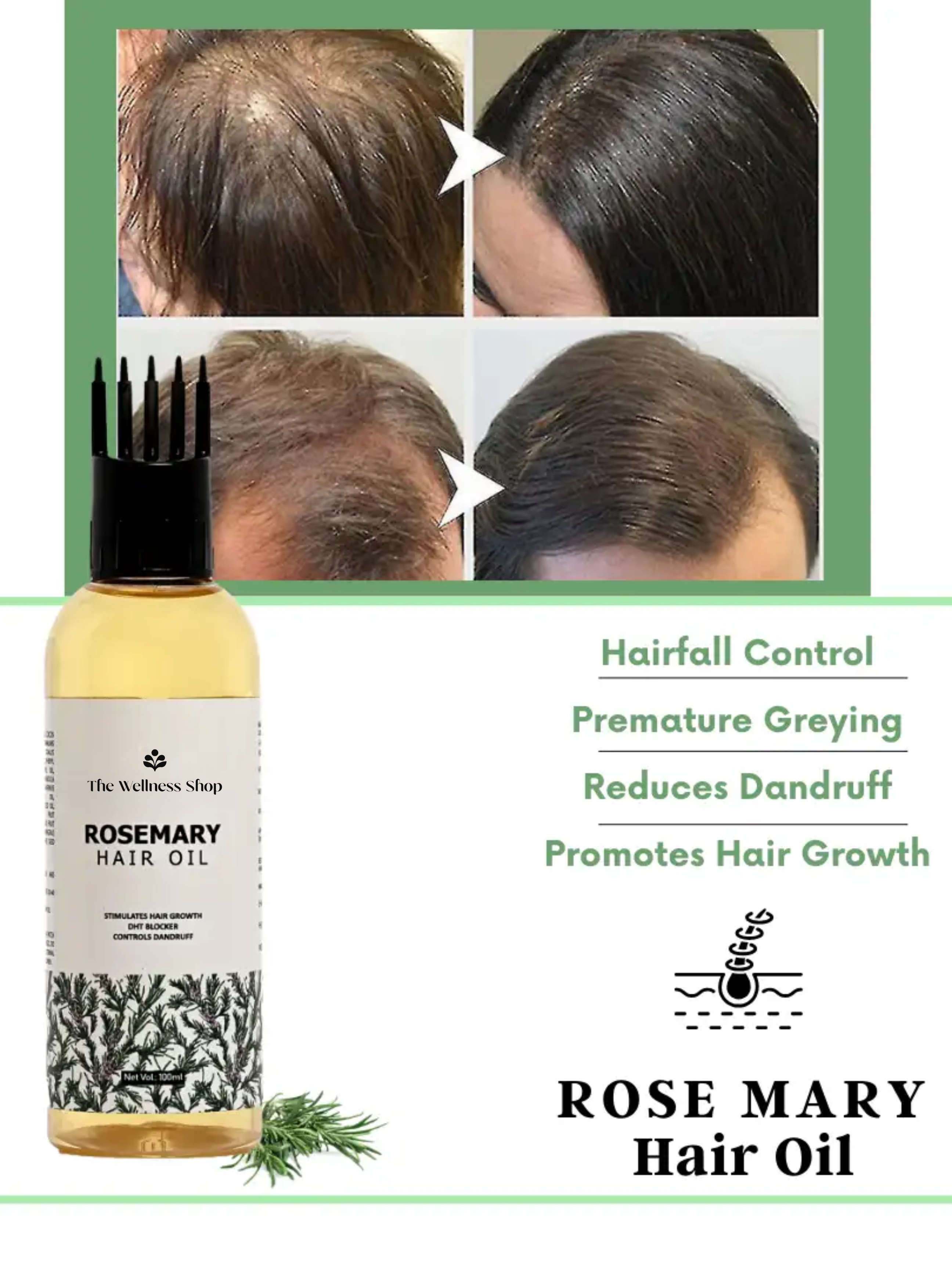 ROSEMARY HAIR OIL FOR HAIR REGROWTH AND STRENGTH (CONTROLS HAIR FALL IN 4 WEEKS)