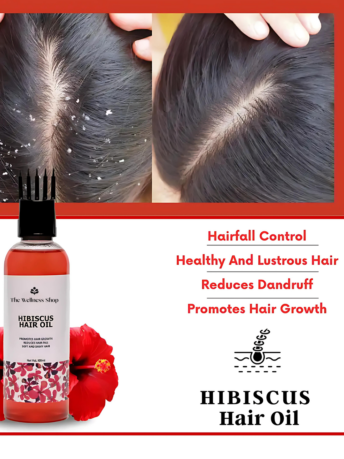 HIBISCUS HAIR OIL FOR HAIR FALL CONTROL AND REGROWTH (CONTROL HAIR FALL IN 4 WEEKS)