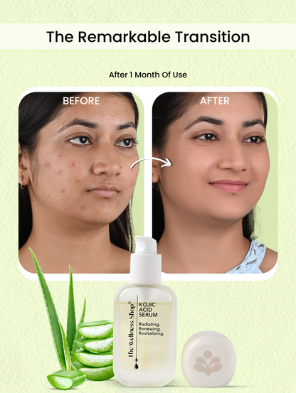 Kojic Acid Serum