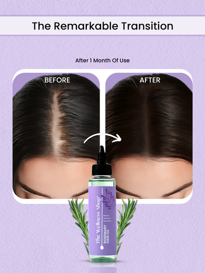 ROSEMARY HAIR OIL FOR HAIR REGROWTH AND STRENGTH (CONTROLS HAIR FALL IN 4 WEEKS)