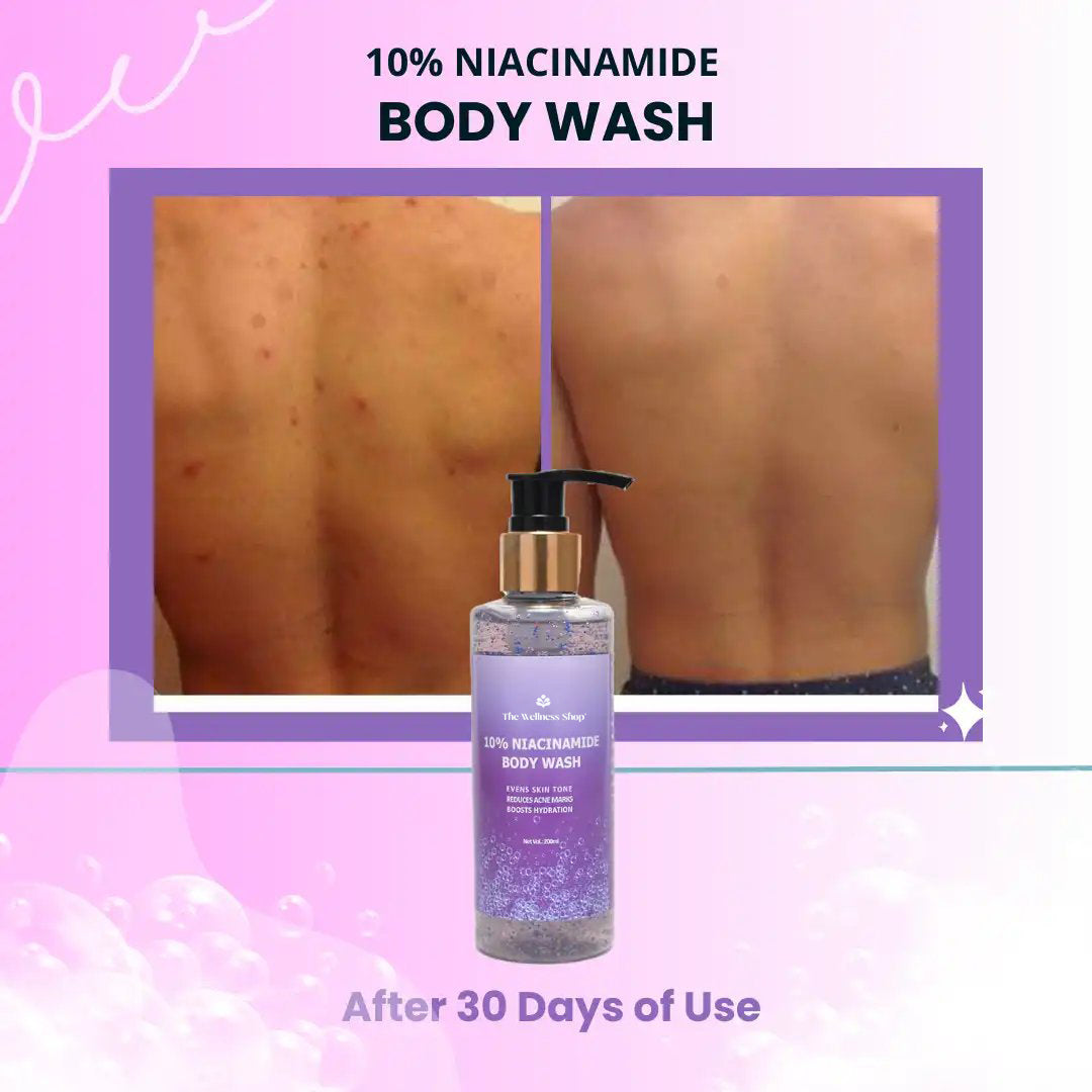 10% NIACINAMIDE BODY WASH ( FADES BLEMISHES, GLOWING SKIN, SULPHATE AND PARABEN FREE)