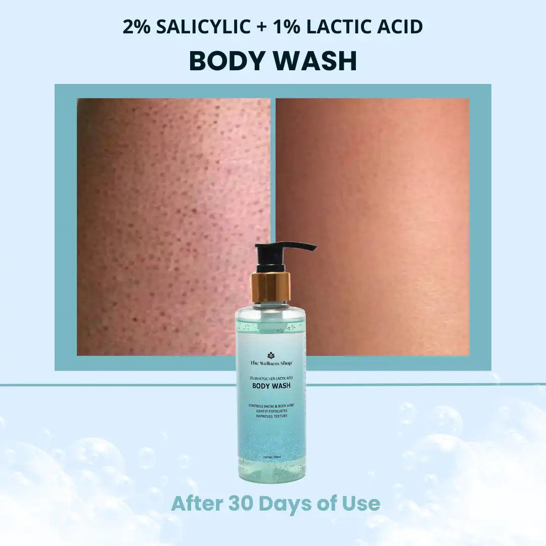 2% SALICYLIC + 1% LACTIC ACID BODY WASH (NATURALLY EXFOLIATES &amp; HYDRATES, SULPHATE AND PARABEN FREE)