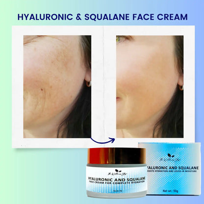 HYALURONIC AND SQUALANE FACE CREAM FOR COMPLETE HYDRATION