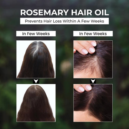 ROSEMARY HAIR OIL FOR HAIR REGROWTH AND STRENGTH (CONTROLS HAIR FALL IN 4 WEEKS)